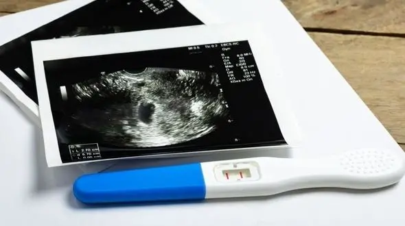 رئیسی: آمار سقط جنین نگران کننده است؛ دستگاه قضا ورود کند/ آقای رئیس جمهور علت اصلی را باید در وزارت بهداشت،اقتصاد و کار جستجو کنید!