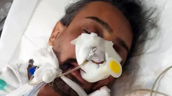 کمای مرد زن و بچه دار با عمل زیبایی / همسرش بر سر دو راهی + عکس