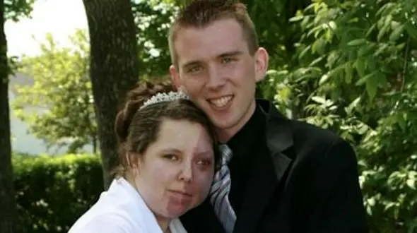 ماه گرفتگی که این زن را شبیه به هیولا کرد! + عکس 