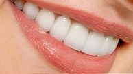 راه حل جدید محققان برای مبارزه با پوسیدگی دندان ها!