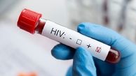 بیش از ۵۰۰ نفر در شیروان برای شناسایی به موقع بیماری ایدز آزمایش دادند