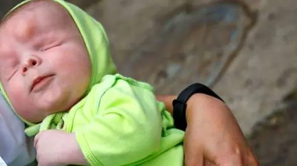 تولد نوزاد بدون چشم در روسیه + عکس