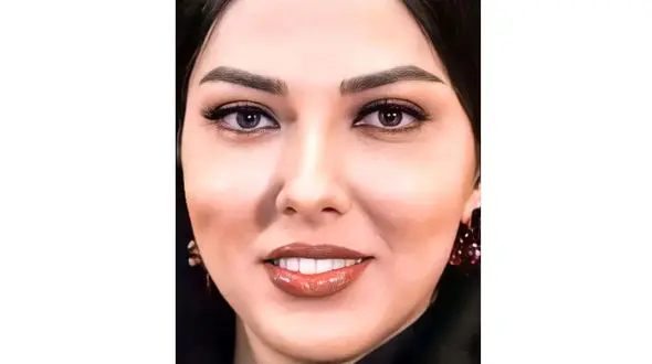 لیلا اوتادی پیش از جراحی زیبایی / عکس از چهره عجیب خانم بازیگر که نباید منتشر می شد!