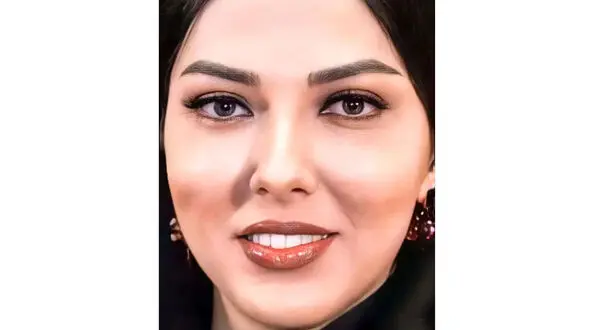 لیلا اوتادی پیش از جراحی زیبایی / عکس از چهره عجیب خانم بازیگر که نباید منتشر می شد!