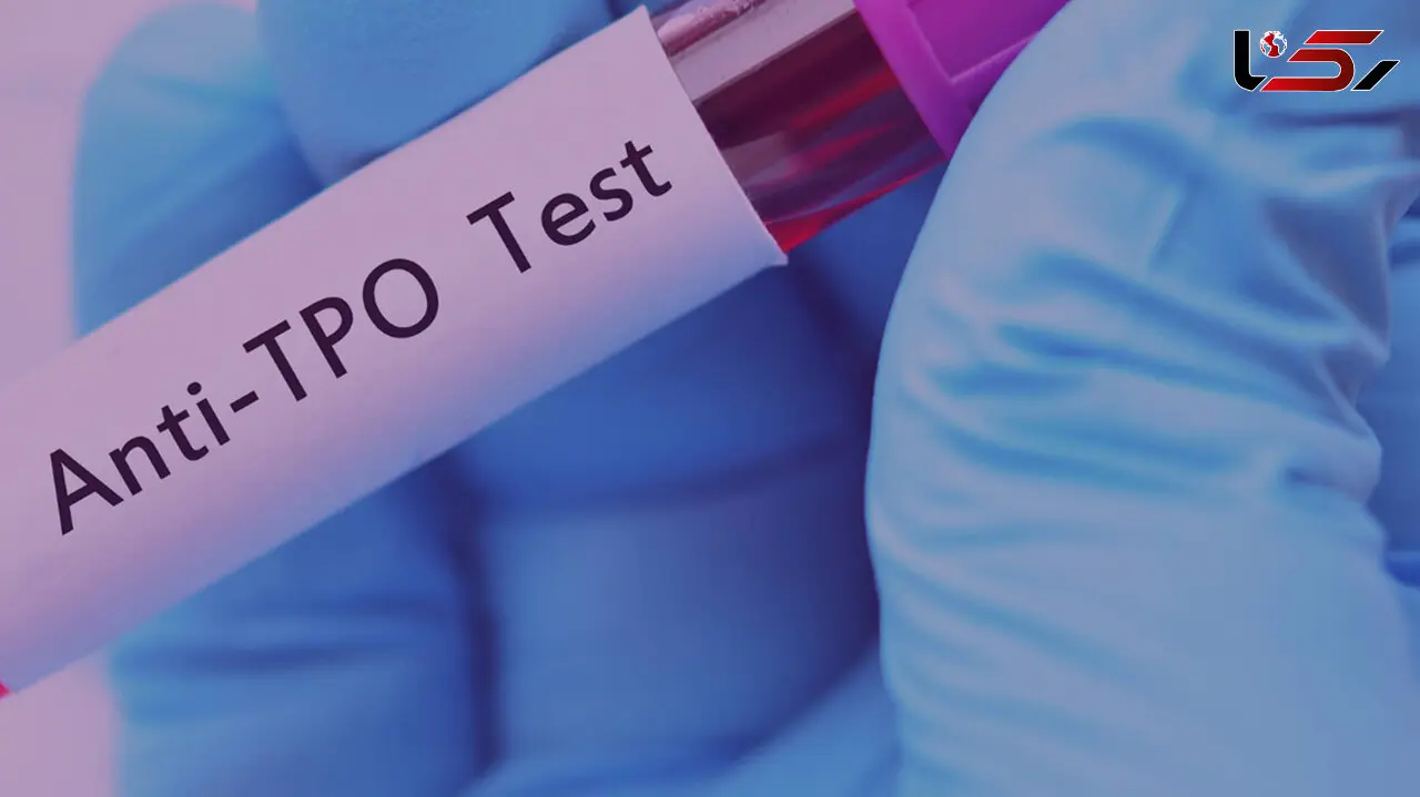 بالا بودن anti tpo نشانه چیست؟