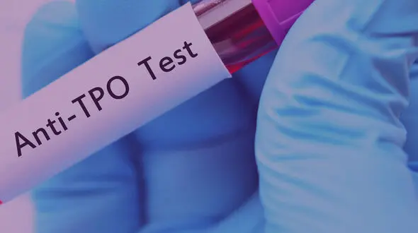بالا بودن anti tpo نشانه چیست؟