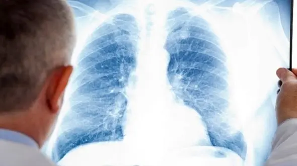 ریه هایتان را از هر بیماری واکسینه کنید