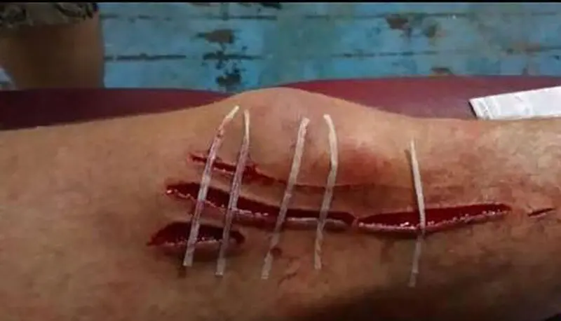 8017430_171