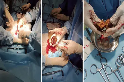 هشدار جدی برای شب یلدا / این میوه را همراه انار نخورید + فیلم