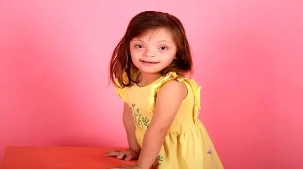 مدلینگ شدن کودک مبتلا به سندرم داون + عکس