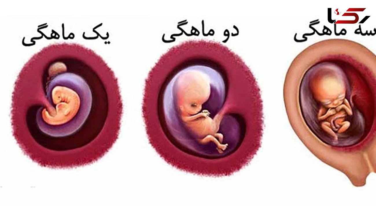مراقبت‌های ویژه 3 ماه اول بارداری