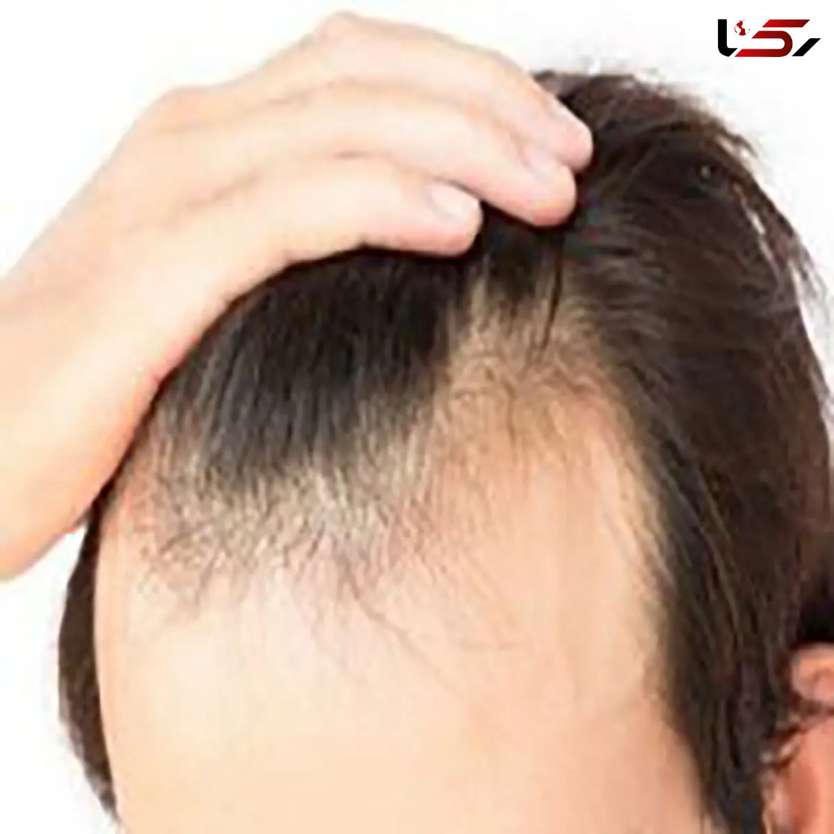 آیا رنگ کردن مو باعث ریزش مو می شود؟