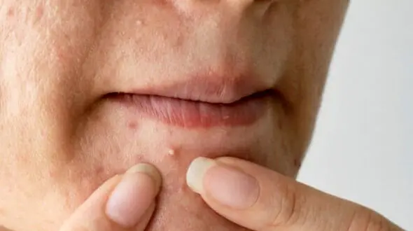 چه کنیم جوش مجلسی نزنیم؟