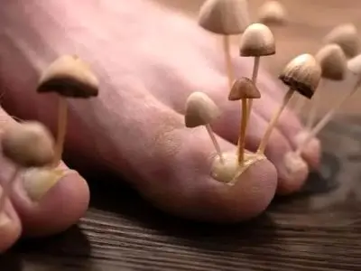 راهی عجیب: درمان قارچ ناخن با تخم‌ مرغ گندیده