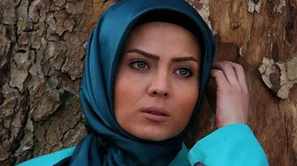 تغییر چهره خانم بازیگر چشم رنگی تلویزیون ایران + عکس سولماز آقمقانی قبل و بعد عمل !