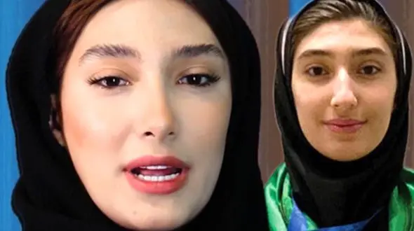 فیلم واکنش جذاب مبینا نعمت زاده قهرمان تکواندوکار به عمل های زیبایی اش ! 