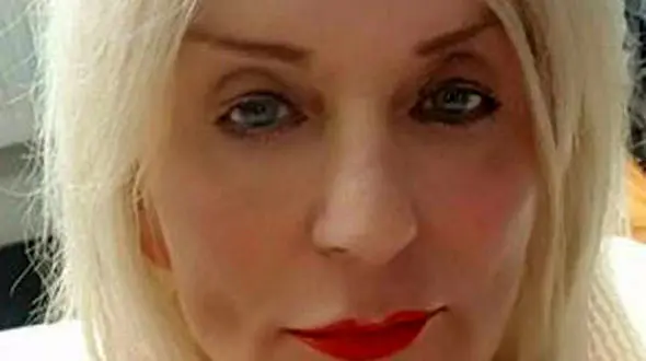 جراحی زیبایی زشت ترین پیرزن را زیبا کرد+ عکس