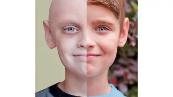 بخشی از عوارض شیمی درمانی قابل پیشگیری است