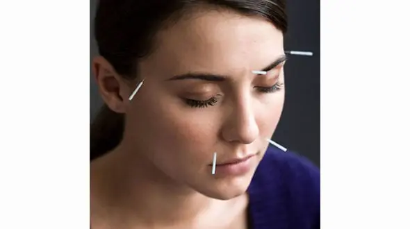 اضطراب تان را با طب سوزنی درمان کنید