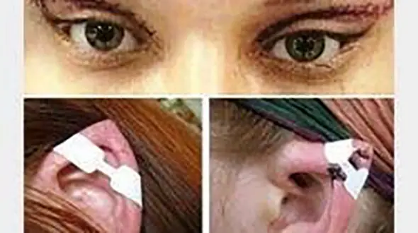 
وقتی زیبایی به گوش‌های الاغی ختم می‌شود!
