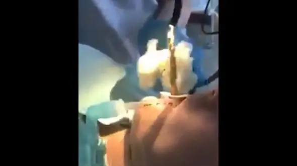 خارج کردن مار یک متری از حلق یک زن روس + فیلم