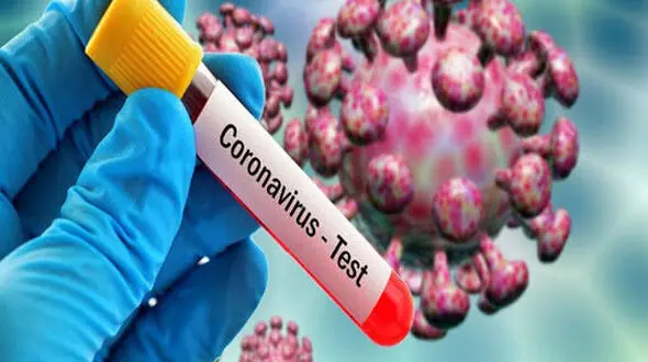 پیشنهادهای طلایی به افراد مشکوک به کرونا 