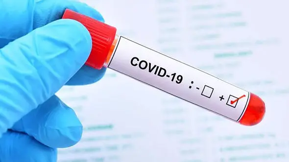 جدیدترین رنگ‌بندی کرونایی شهرهای کشور + اینفوگرافیک