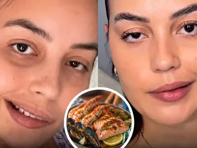 خوردن این غذا باعث فلج صورت زن جوان  شد / علایمش چیست ؟! + عکس دختر و اسم غذا