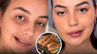 خوردن این غذا باعث فلج صورت زن جوان  شد / علایمش چیست ؟! + عکس دختر و اسم غذا