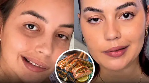 خوردن این غذا باعث فلج صورت زن جوان  شد / علایمش چیست ؟! + عکس دختر و اسم غذا