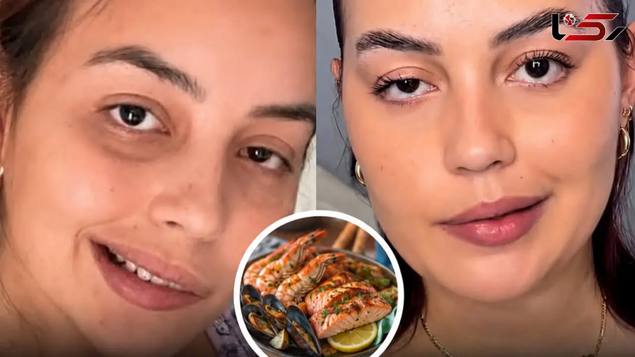 خوردن این غذا باعث فلج صورت زن جوان  شد / علایمش چیست ؟! + عکس دختر و اسم غذا