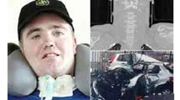 بازگشت ناباورانه  به زندگی پس از قطع سر + عکس