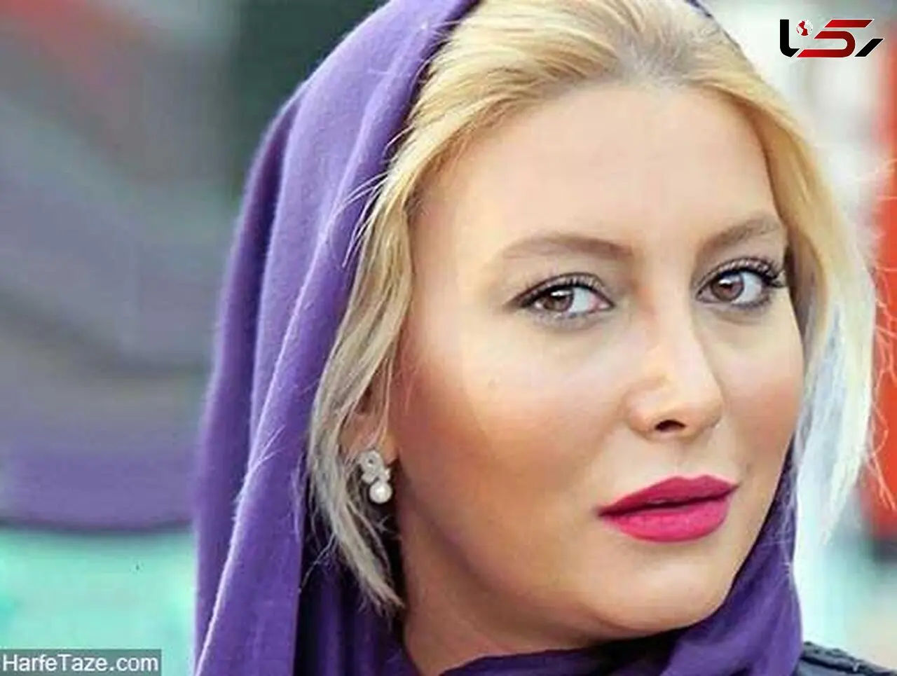   صورت فریبا نادری با عمل های زیبایی !  