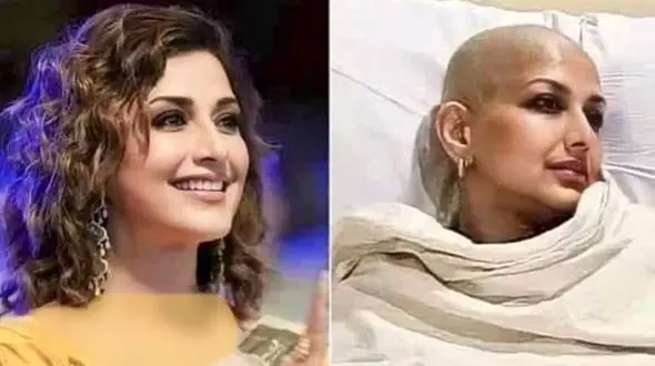 نامه جگرسوز  دختر فوق زیبا قبل از مرگ ! / من 7 آرایشگر داشتم الان مویی بر سر ندارم ! 