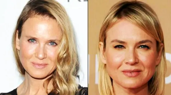 ناراحتی شدید بازیگر زن از توهین‌های کاربران درباره چهره‌اش + عکس
