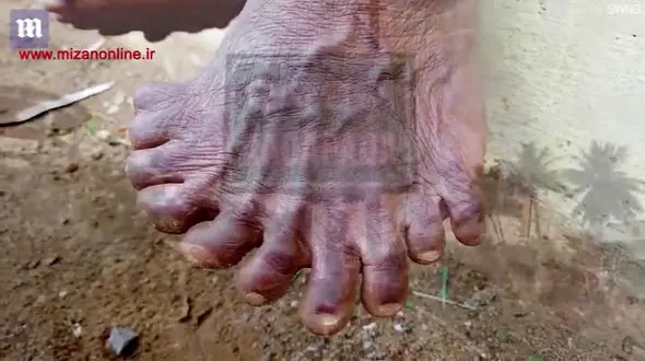 
زنی هندی با انگشتانی عجیب و غریب+عکس
