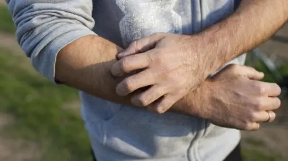 عامل درد و خارش پوست کشف شد