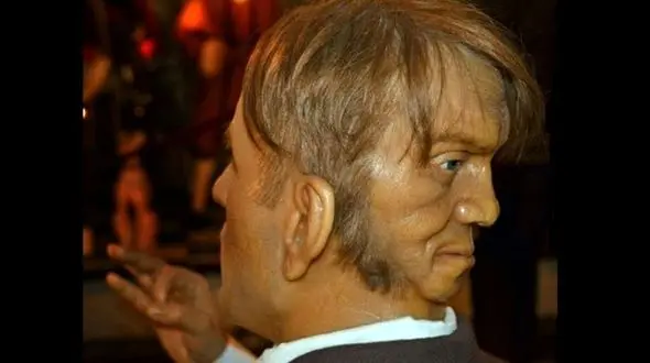 خودکشی عجیب ترین مرد جهان بخاطر اختلال ژنتیکی / این مرد فقط می خندید