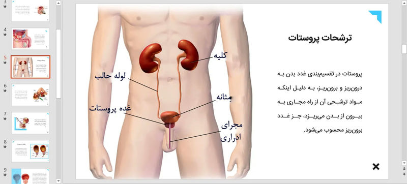 پروستات