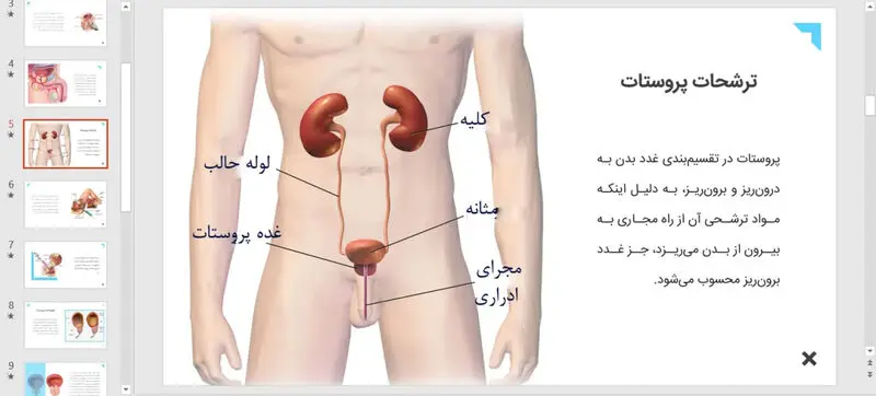 پروستات