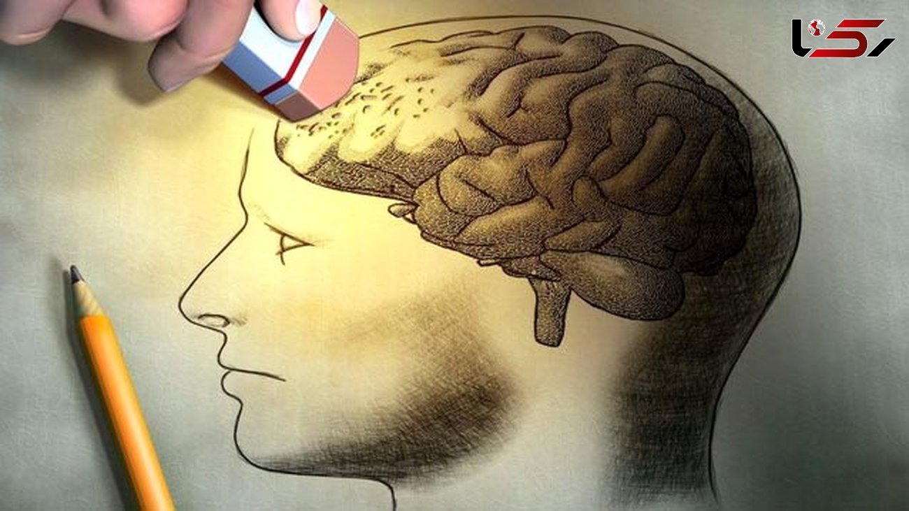 آلزایمر از سایر نقاط بدن به مغز می رسد