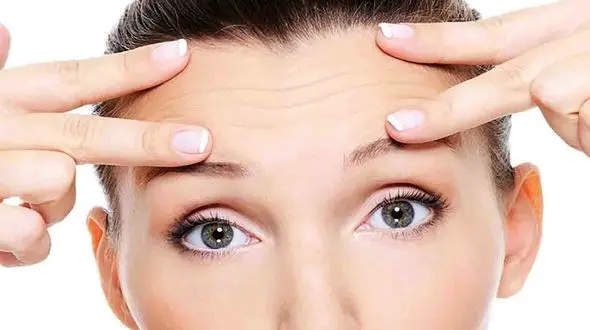 لیفت شقیقه چیست؟