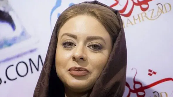  تغییر چهره شدید زهرا اویسی / خانم بازیگر بعد از چند سال با این عکس خبرساز شد 
