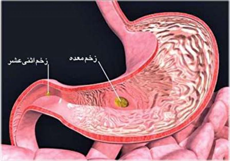 زخم اثنی عشر