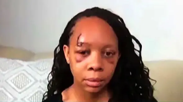 اتفاق وحشتناک برای یک زن / شلیک پلیس بینایی او را گفت + فیلم و عکس