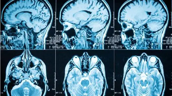 مغز افراد قاتل با دیگران متفاوت است 