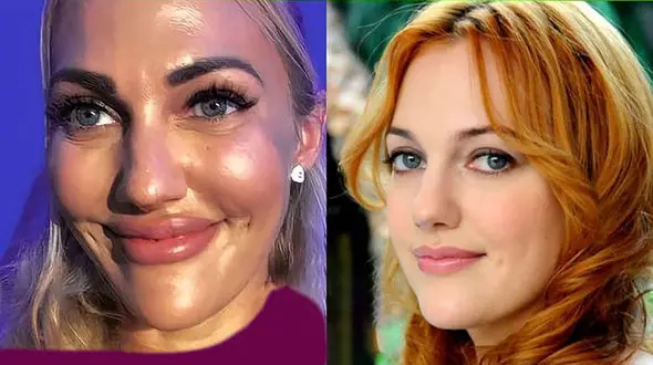 عکس جنجالی از قبل و بعد عمل زیبایی بازیگران زن / شوکه می شوید !