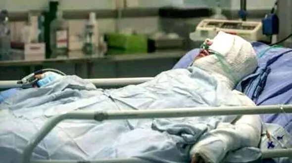 سالی ۳۰ هزار نفر در ایران دچار سوختگی جدی می‌شوند/سوختگی؛ بیماری فقرا
