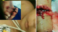 پشت پرده کودک آزاری در سیرجان / به کودک 15 ماهه با قمه حمله شد! + عکس 