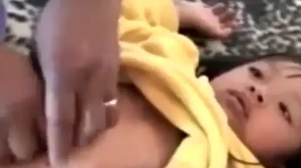 شیوه عجیب جراحی یک مرد اندونزیایی بدون استفاده از تیغ + فیلم